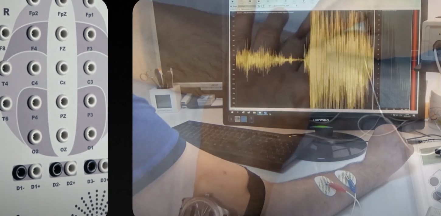 Наши электроэнцефалографы работают в клиниках (у нас 9  регистрационных удостоверений на мед. изделия) 